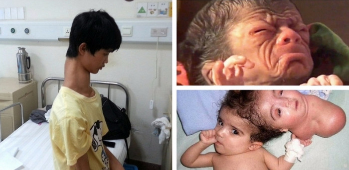 10 Children Born With Incredibly Rare Features