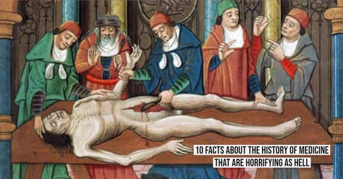 10 Facts About the History of Medicine That are Horrifying as Hell