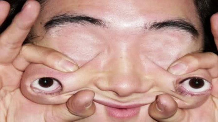 10 Most Bizarre Eyes That Will Creep You Out 
