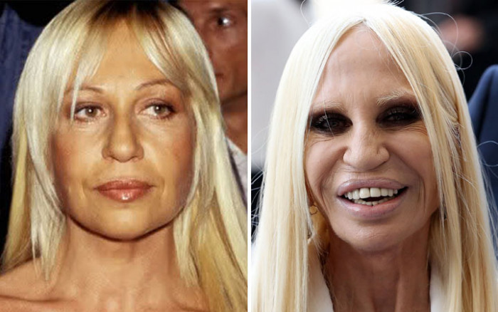 11 Prominent Celebrities who have Aged Horribly