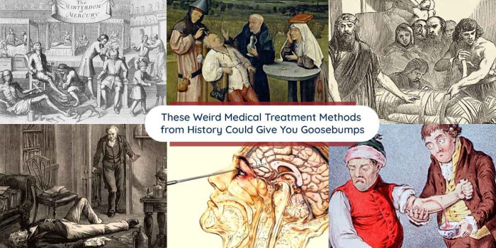 11 Strange Medical Treatment Methods That Scared the Hell Out of Patients 