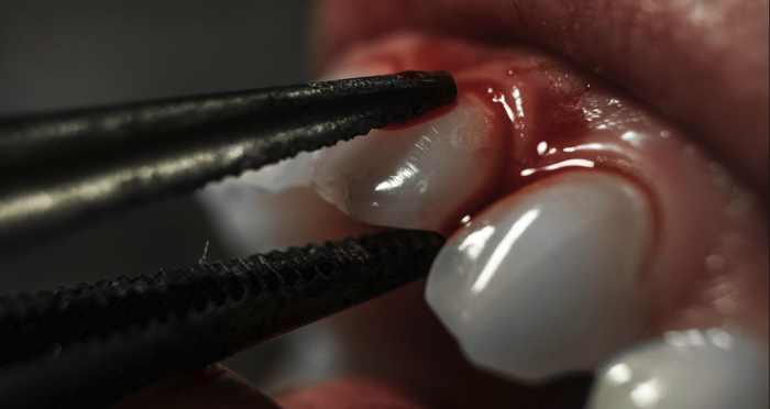 10 Scariest Dentist Accounts That Will Scar You For Life