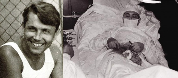 6 Most Shocking Self Surgeries In The History Of Mankind
