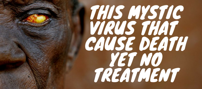 A Mystic Virus Killed a 60 years Man & Remains a Mystery from 10 Years