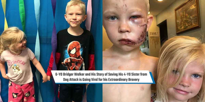 Meet This 6-Year-Old Boy Who Saved His Sister from Dog Attack & Got 90 Stitches