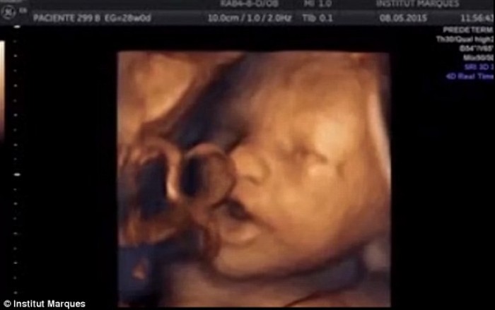 OMG – Baby in the Womb Not Only Listens but also sings