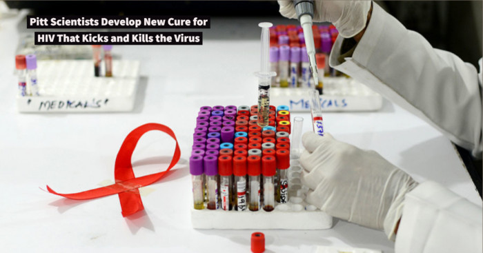 Pitt Scientists Develop New Cure for HIV That Kicks and Kills the Virus