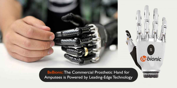 This Commercial Prosthetic Hand by BeBionic is a Boon for Amputees