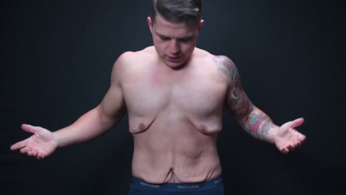 Video On 'Weight Loss Effect On Skin' Is Breaking The Internet - Check It Here 